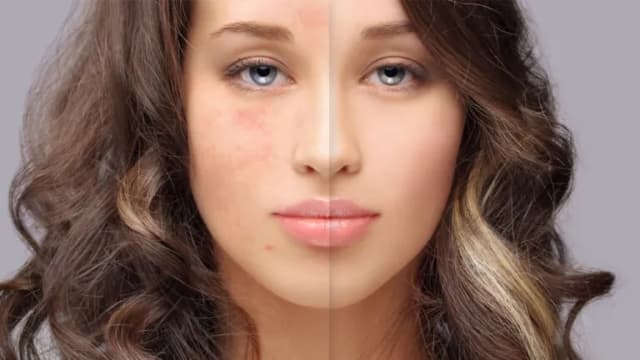 Cera tłusta czego unikać: najgorsze składniki dla Twojej skóry Cera tłusta czego unikać: najgorsze składniki dla Twojej skóry