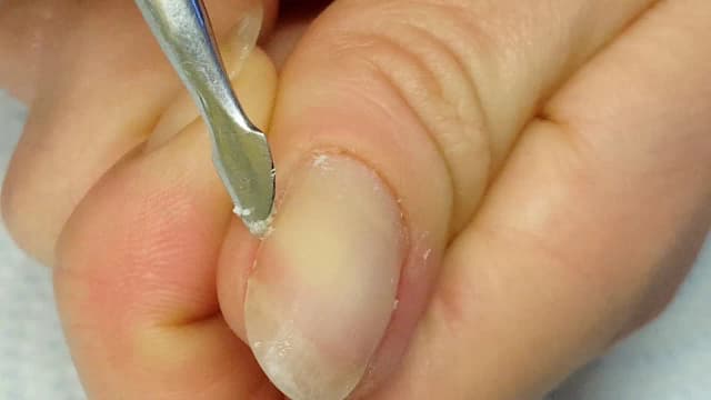 Jak zmiękczyć paznokcie domowym sposobem i pozbyć się twardości Jak zmiękczyć paznokcie domowym sposobem i pozbyć się twardości