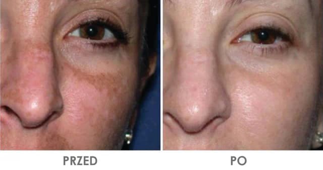 Gdzie kupić deep phyto peeling? Sprawdź najlepsze miejsca w Polsce Gdzie kupić deep phyto peeling? Sprawdź najlepsze miejsca w Polsce